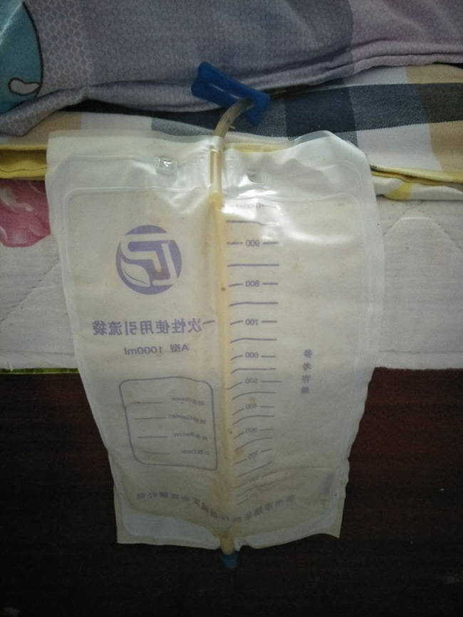 10月4晚上导尿1.jpg