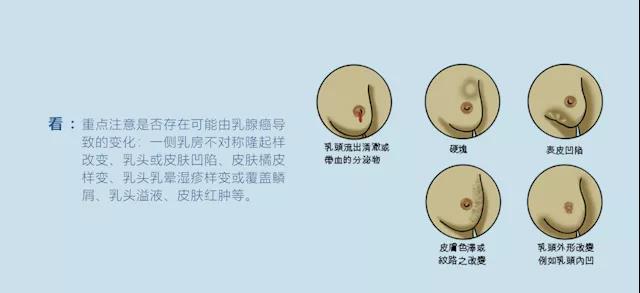 乳腺癌的早期诊断和预防|河南省肿瘤医院乳腺科主任医师陈秀春